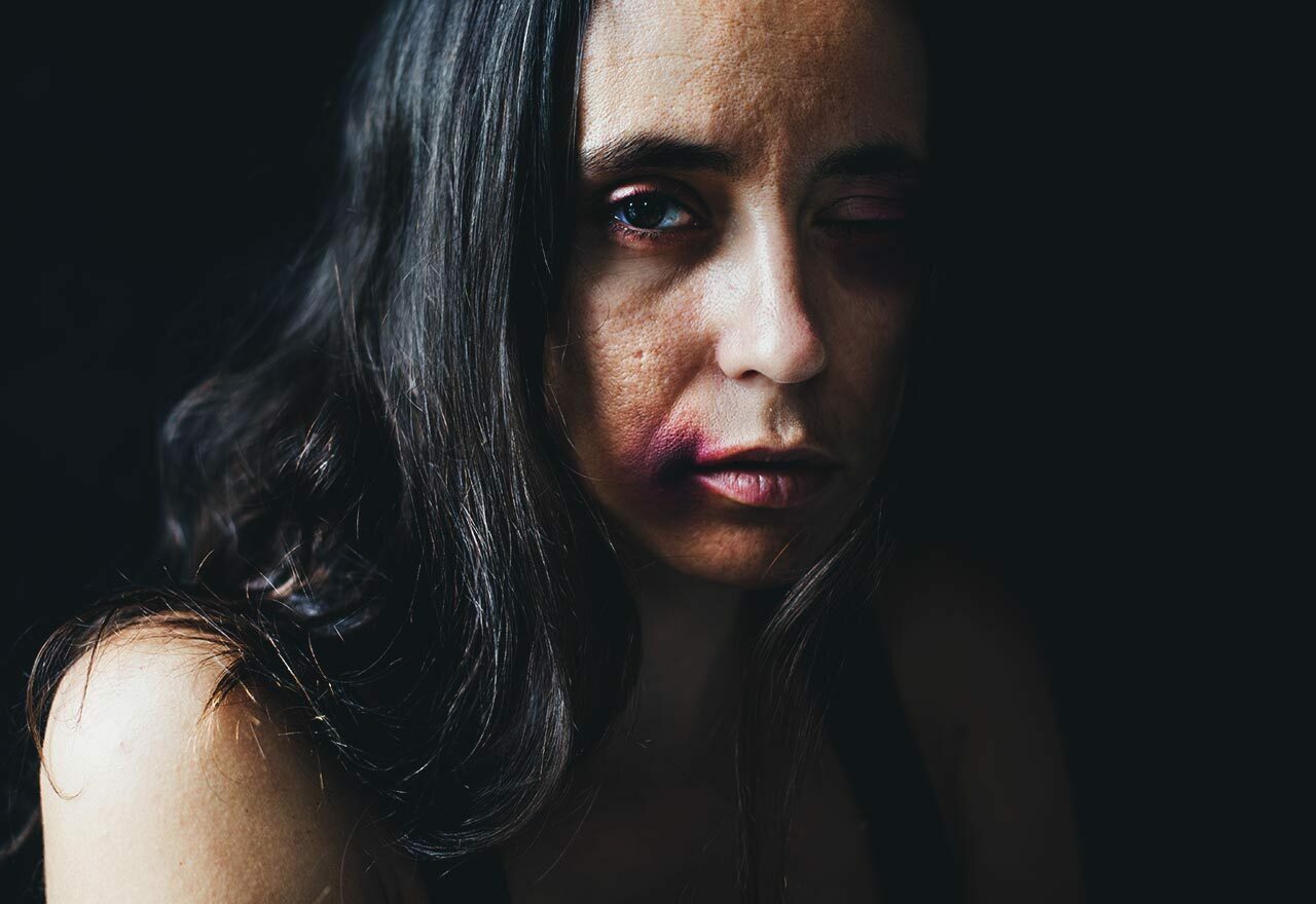 Assault by beating | Defence Solicitors