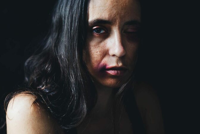 Assault by beating | Defence Solicitors