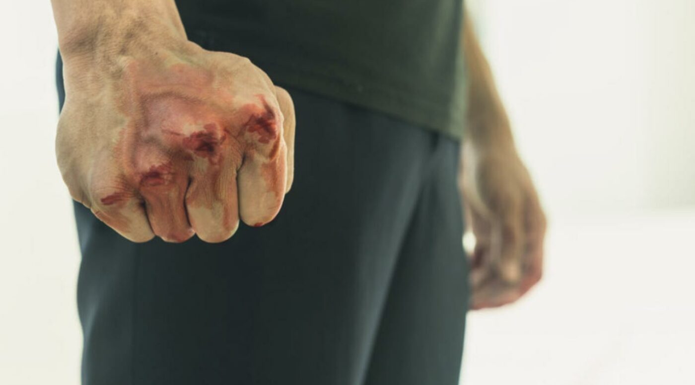 Racially aggravated assault | Assault Lawyers - Stuart Miller Solicitors