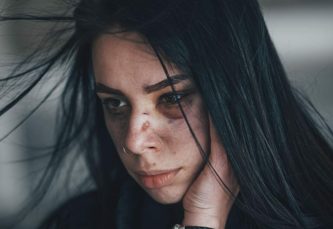 Assault by beating | Assault Lawyers - Stuart Miller Solicitors