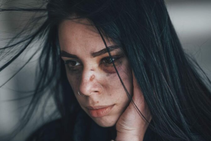 Assault by beating | Assault Lawyers - Stuart Miller Solicitors